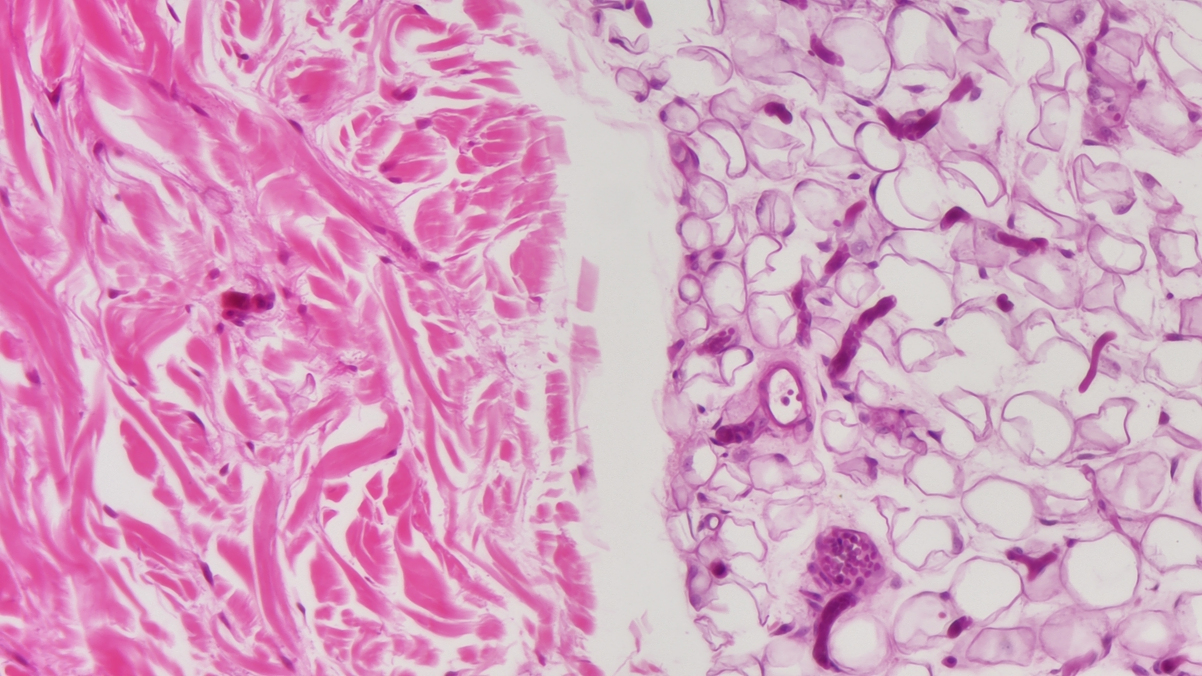 Medical pathology observation Medical pathology observation