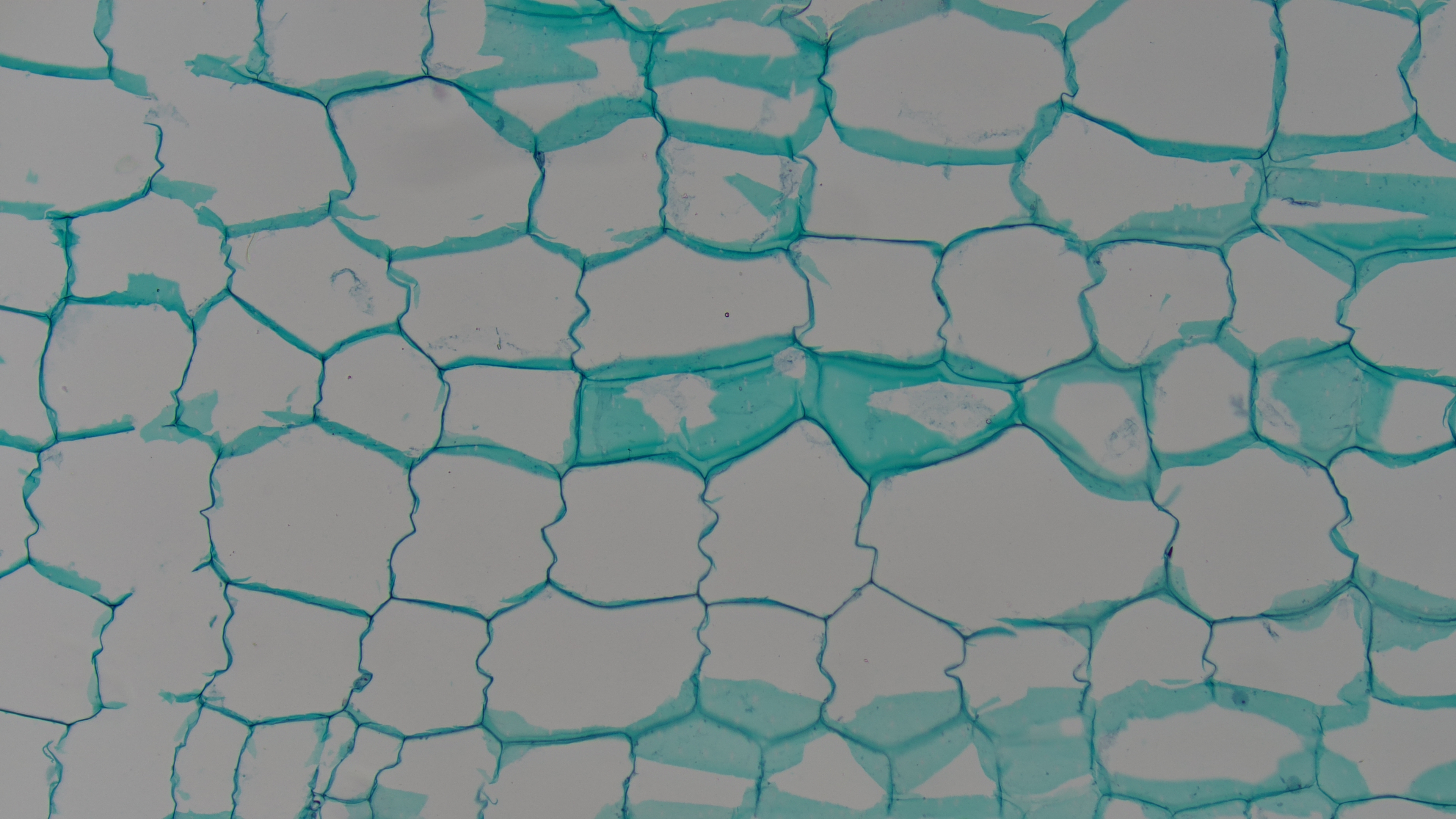 Cucurbitaceae stem longitudinal section Cucurbitaceae stem longitudinal section