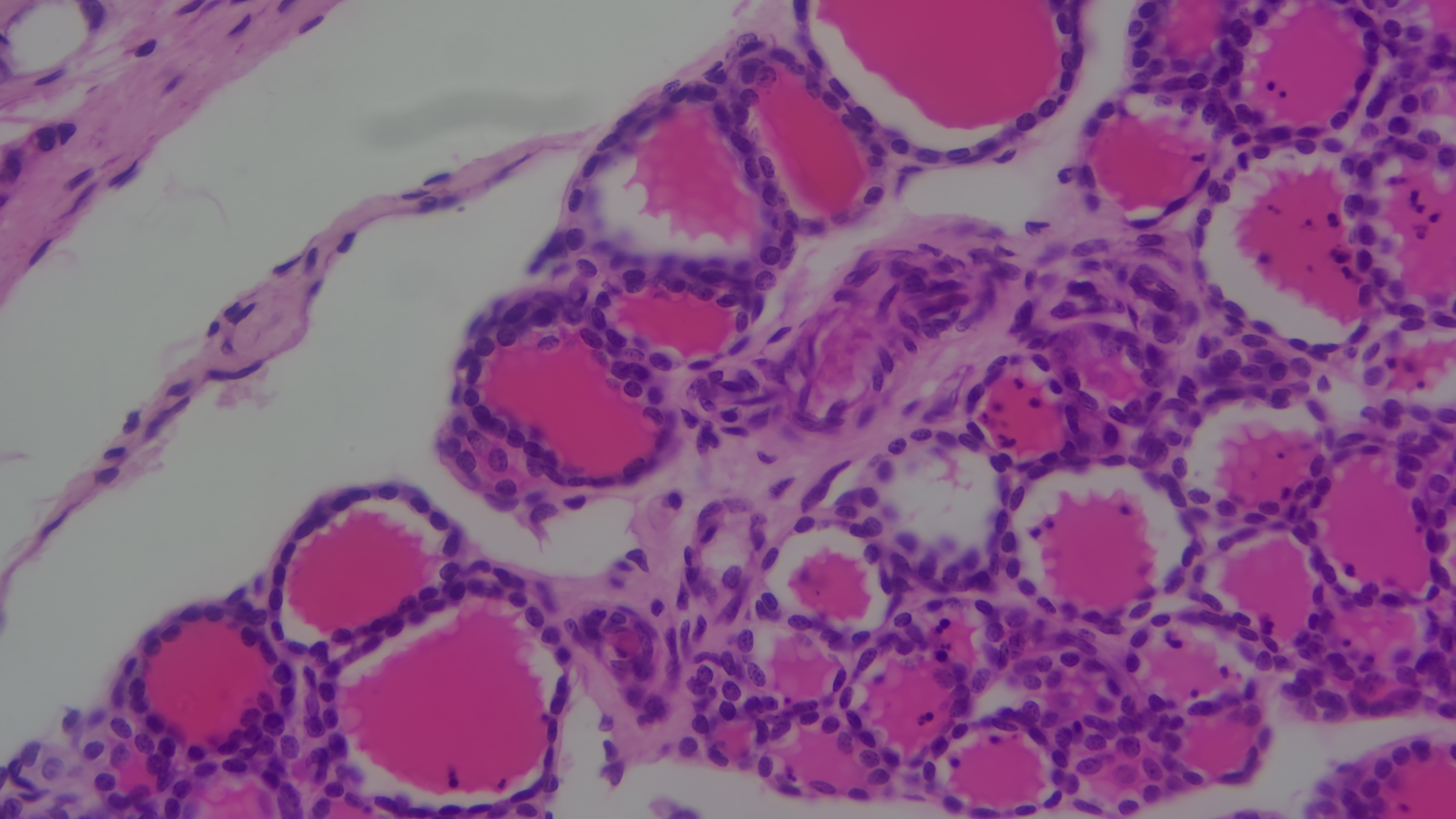Simple cuboidal epithelium cross-section Simple cuboidal epithelium cross-section