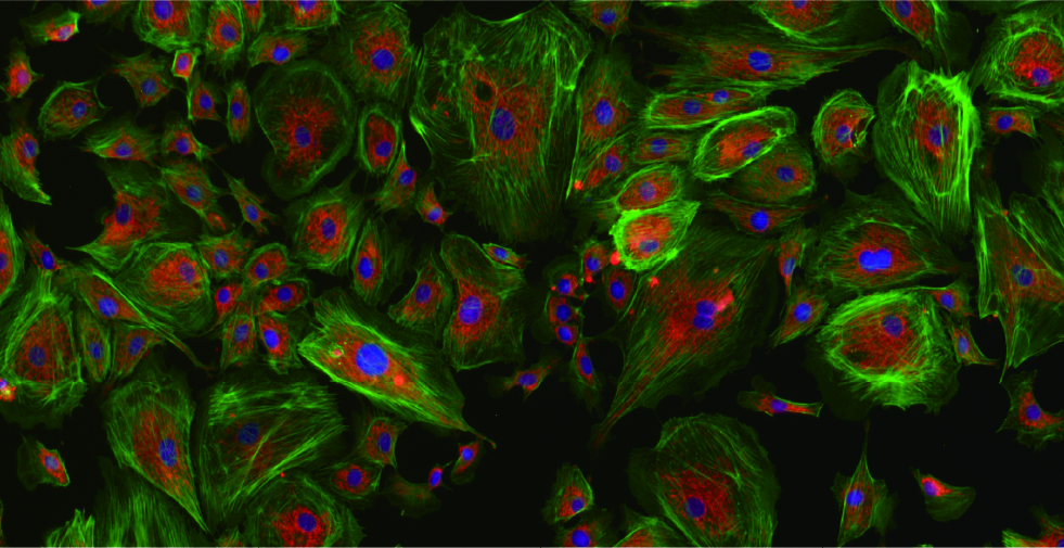 Life sciences sMAX6504B_Application1
