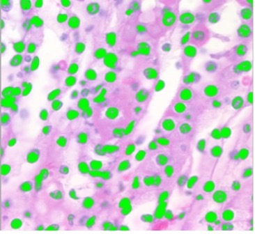 How to use image segmentation and counting How to use image segmentation and counting