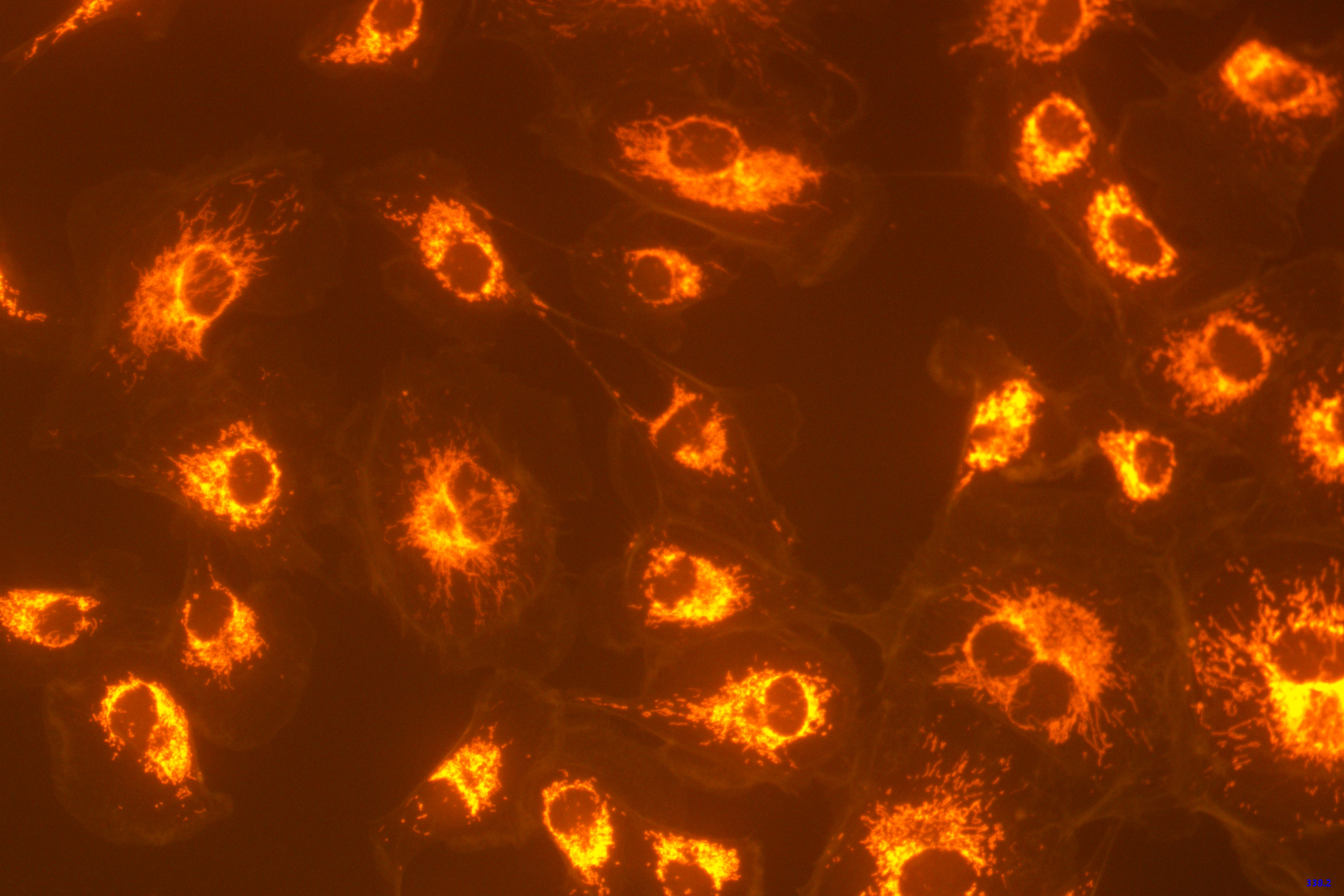 The cells captured by the ToupTek microscope camera